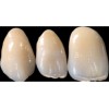 Heraceram Saphir - дентинови маси 20 г