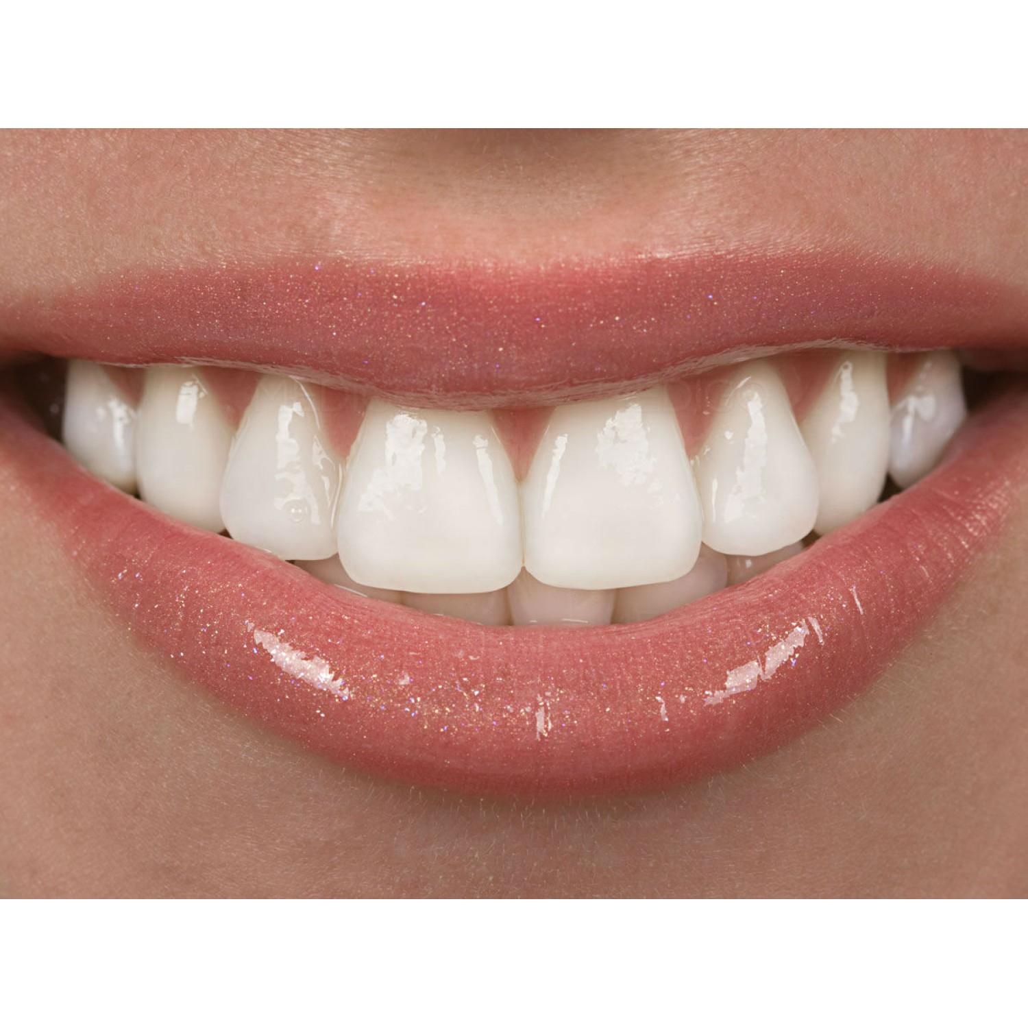 White smile After Whitening mousse 3 мл- десензибилизиращ гел преди и след избелване