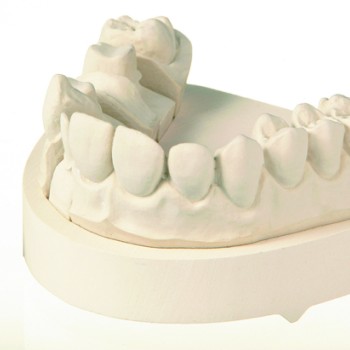 Moldastone CN - висококачествен гипс тип IV - 4.5kg шампанско