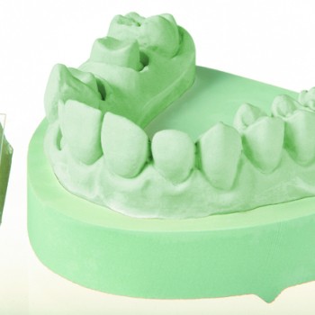 Moldastone CN - висококачествен гипс тип IV - 4.5kg светло зелен