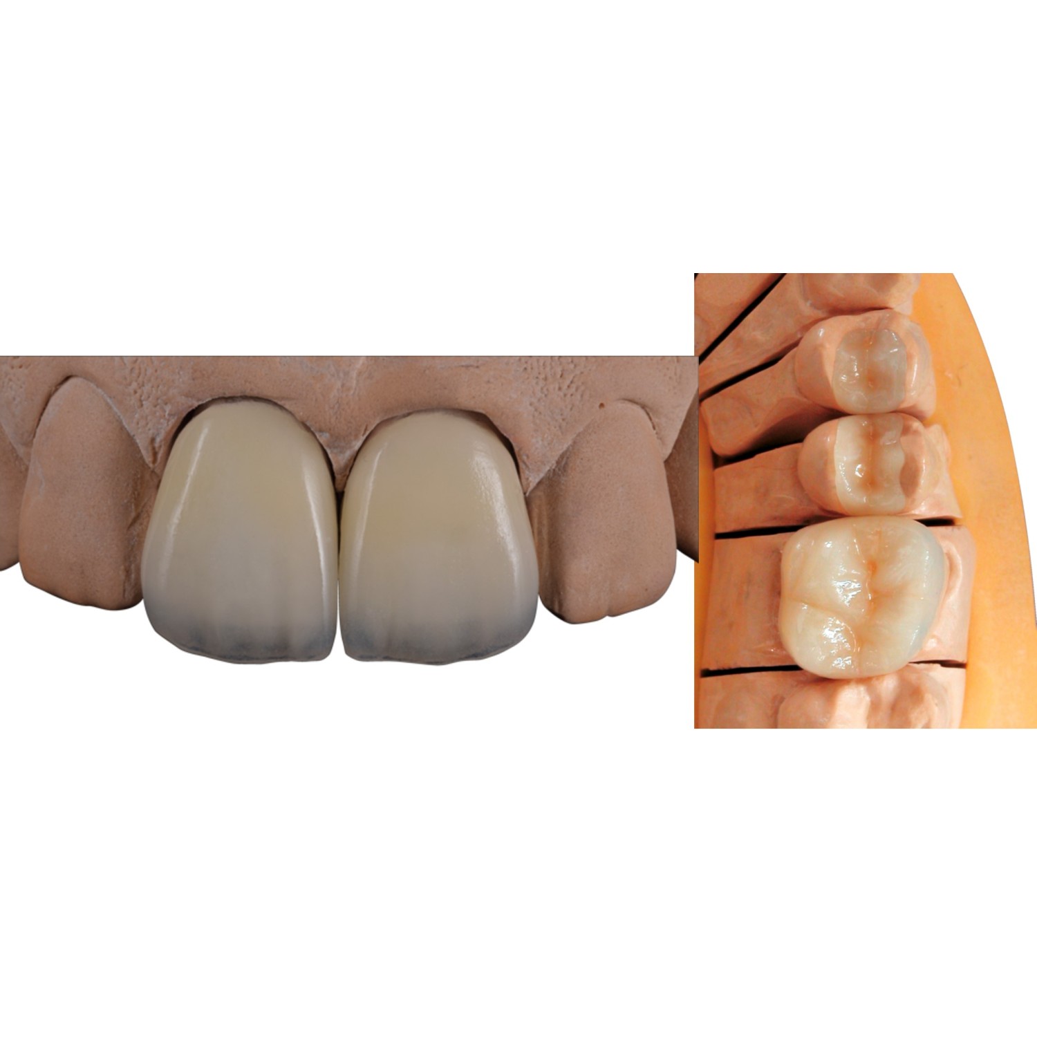 Gluma Ceramic Primer 4 ml - активиран силан за керамика
