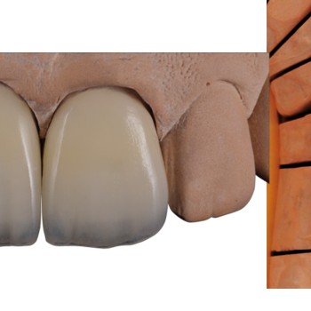 Gluma Ceramic Primer 4 ml - активиран силан за керамика