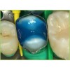 Gluma Total Etch 2.5 ml - ецващ гел за тотално ецване на дентина и емайла