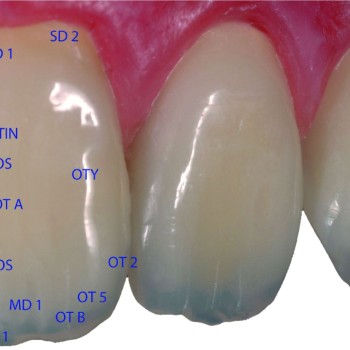 Signum dentine 4g Signum от любов към перфекционизма