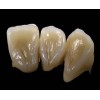Signum Ceramis dentine 1x4 g. Signum Ceramis – Истинска алтернатива на чистата керамика