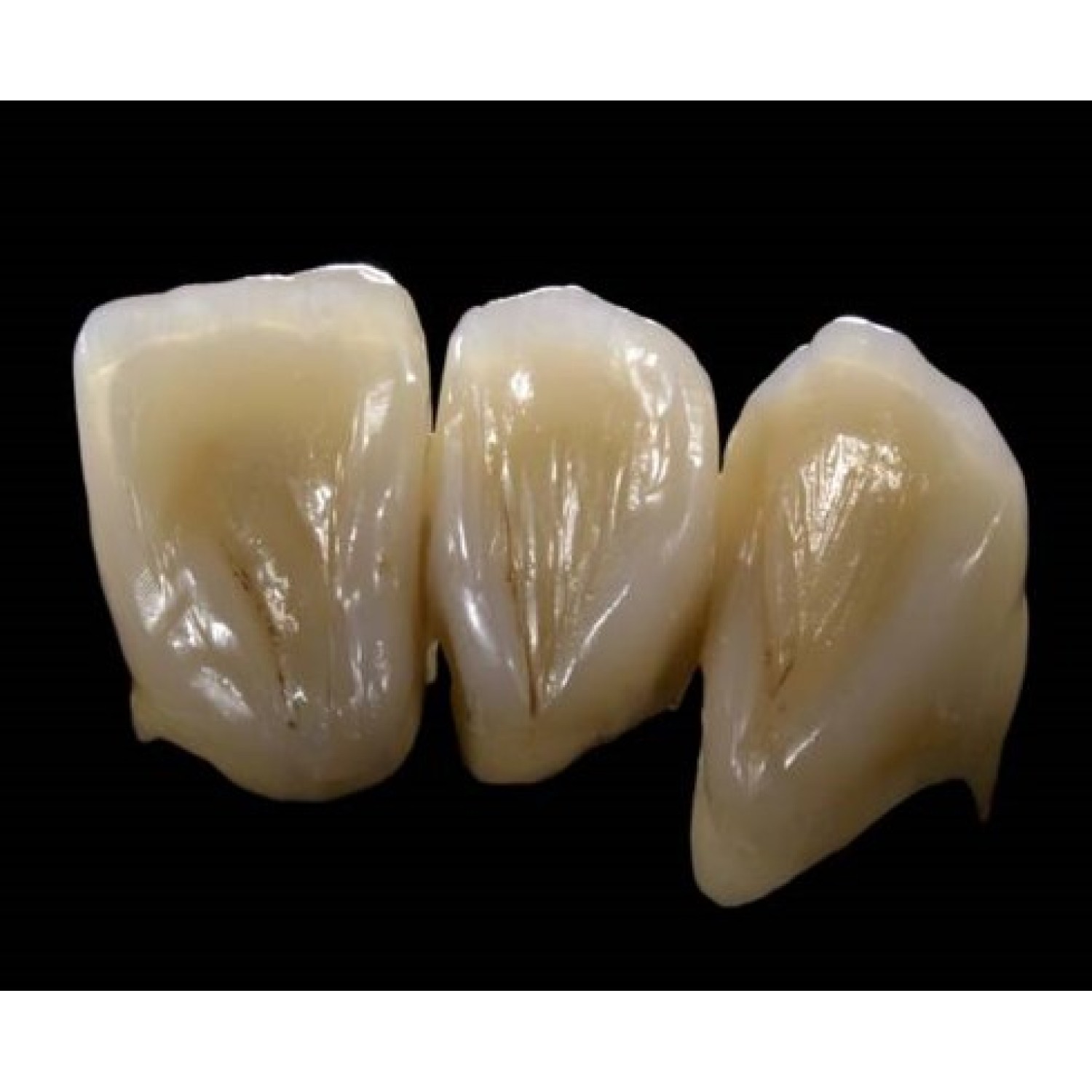 Signum Ceramis dentine 1x4 g. Signum Ceramis – Истинска алтернатива на чистата керамика