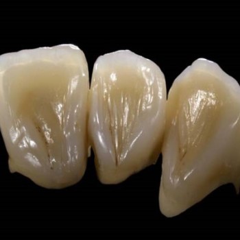 Signum Ceramis dentine 1x4 g. Signum Ceramis – Истинска алтернатива на чистата керамика