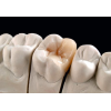 Signum Ceramis dentine 1x4 g. Signum Ceramis – Истинска алтернатива на чистата керамика
