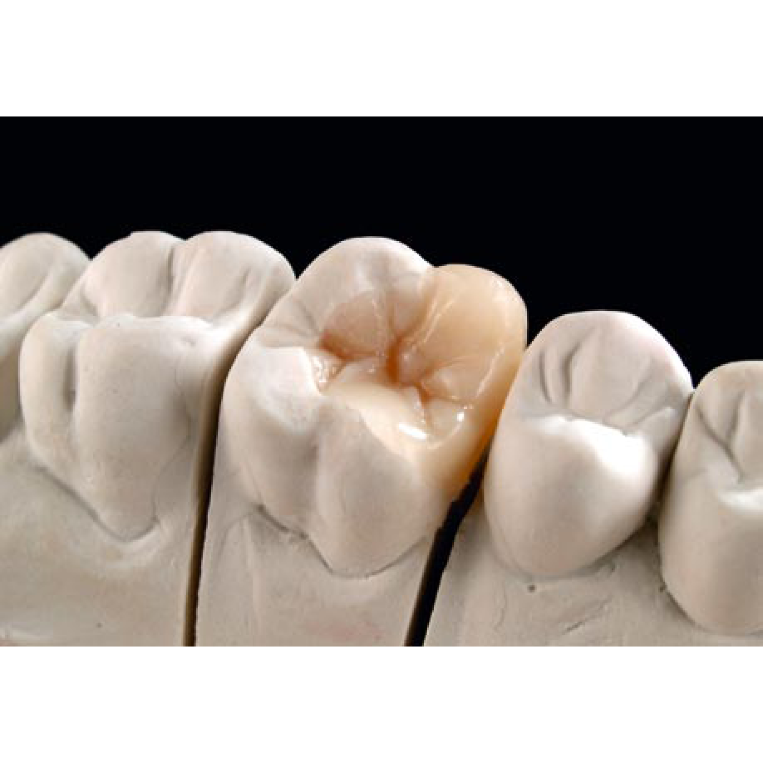 Signum Ceramis dentine 1x4 g. Signum Ceramis – Истинска алтернатива на чистата керамика