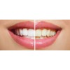 Whitening Toothpaste - избелваща паста за зъби