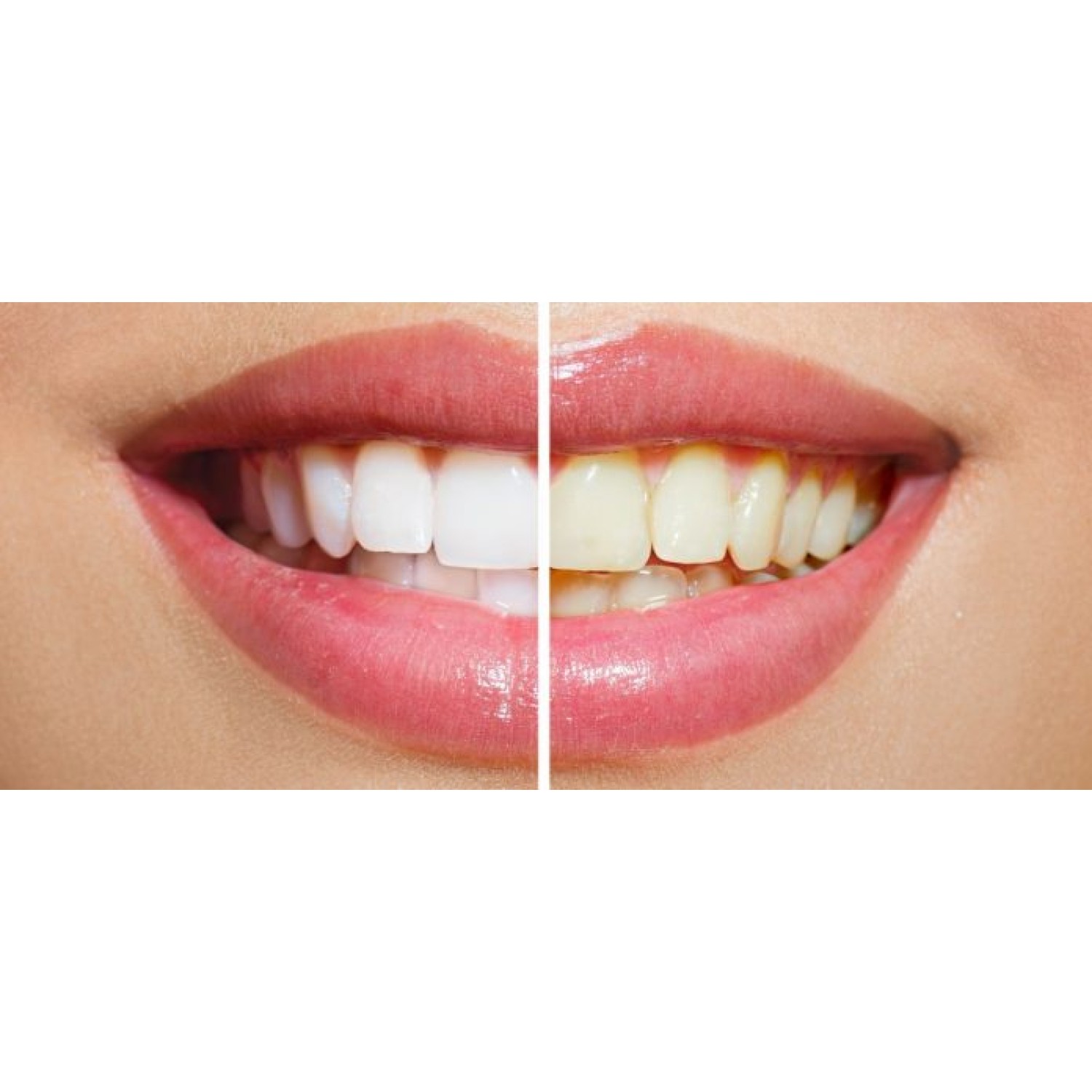 Whitening Toothpaste - избелваща паста за зъби