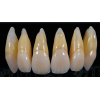Heraceram Zirconia - за инкрустиране на конструкции от циркония Increaser set