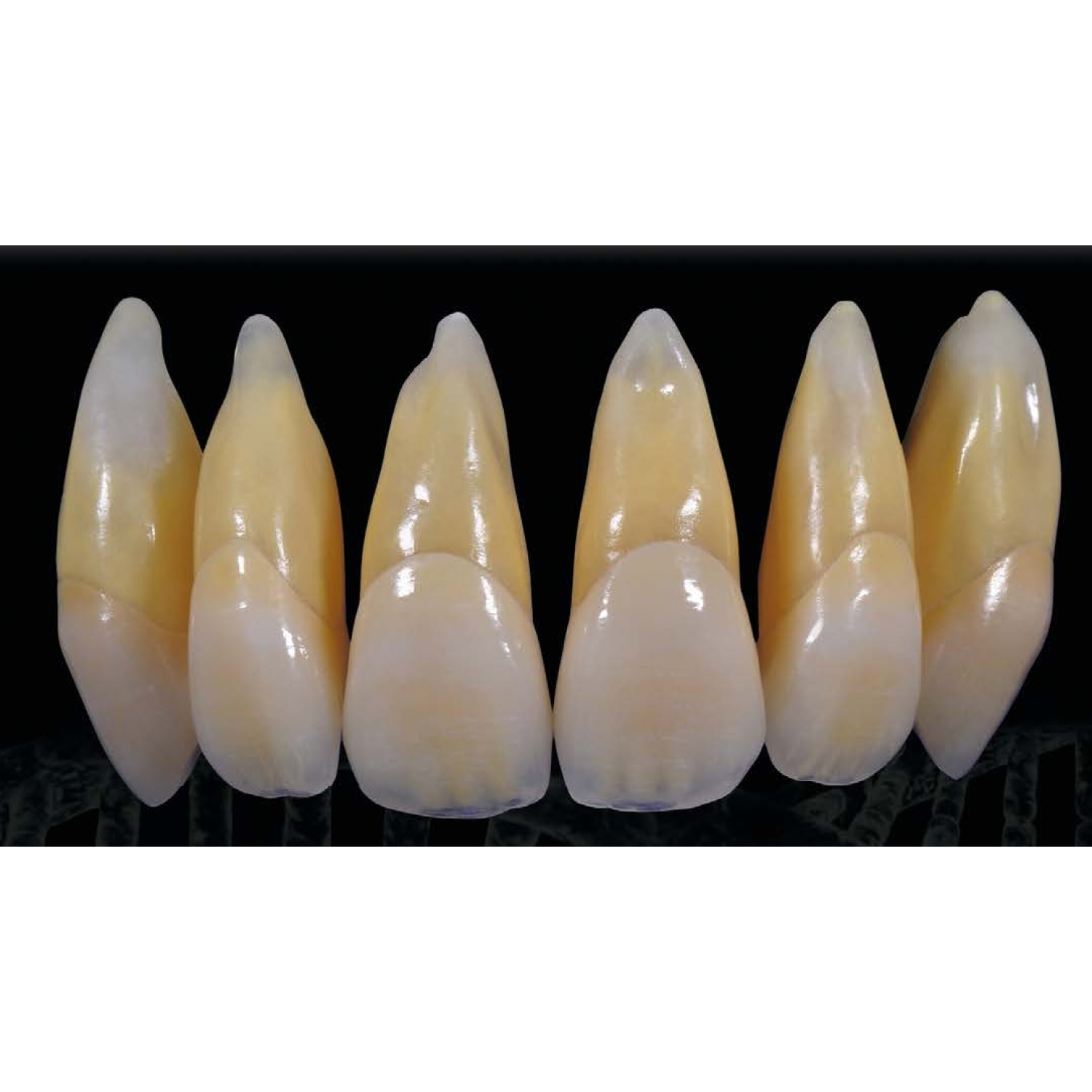 Heraceram Zirconia - за инкрустиране на конструкции от циркония Increaser set