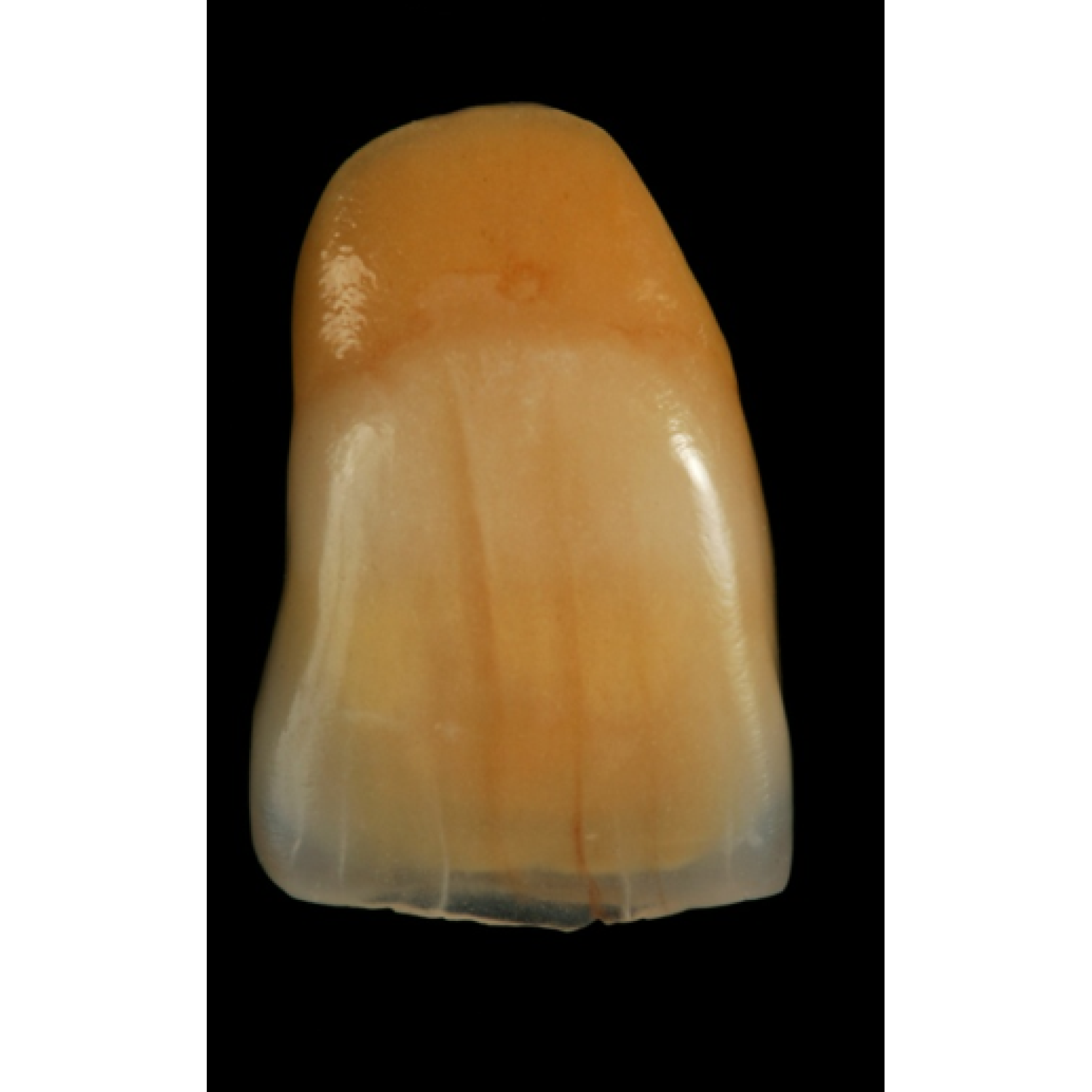 Heraceram Zirconia - за инкрустиране на конструкции от циркония Increaser set
