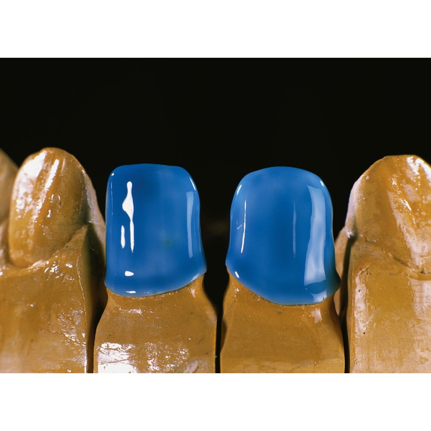 Heraceram Zirconia - за инкрустиране на конструкции от циркония Zirconia adhesive